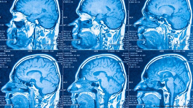 Durante siglos se pensó que el cerebro era un único órgano. Un equipo de Stanford revela ahora que