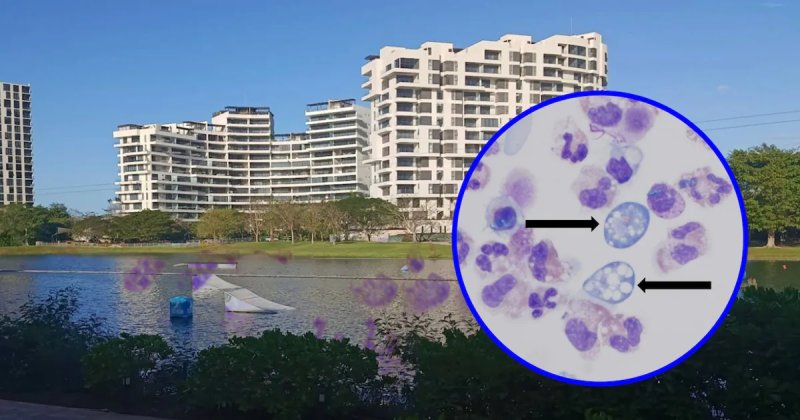 El InDRE confirmó que hay presencia de la 'ameba comecerebros' en un lago artificial en Mérida