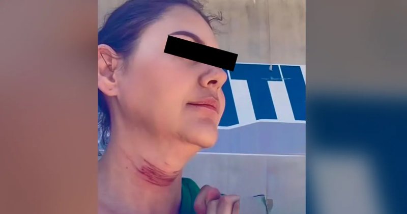 Una mujer identificada como Laura se quitó la vida en el Viaducto Elevado Tijuana; previamente