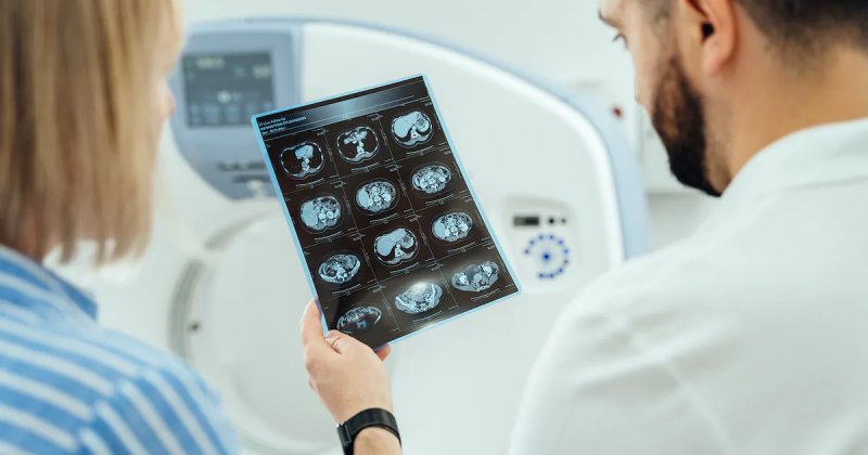 Cáncer de aparición temprana: Estos son los 6 tipos que más afectan a adultos menores de 50 años