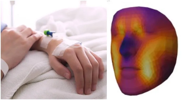 Con verle la cara, descubriría IA quién tiene cáncer